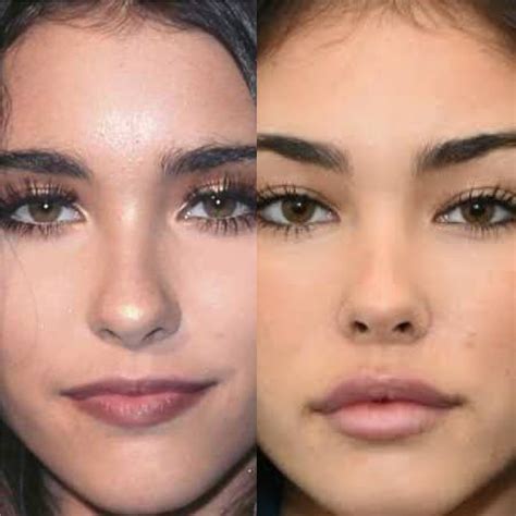 madison beer plastic sugery|Madison Beer Denies Plastic Surgery Rumors, But Heres What。